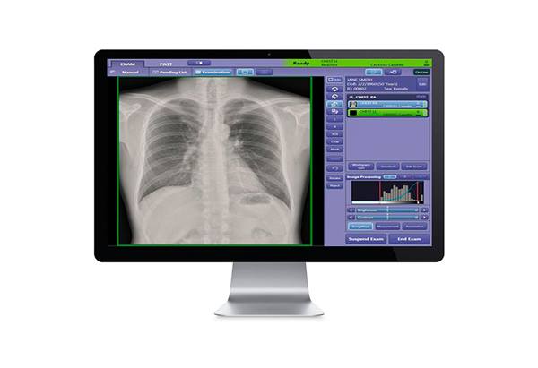 CXDI Control Software NE