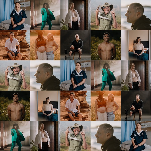 The Story of Scars heroes