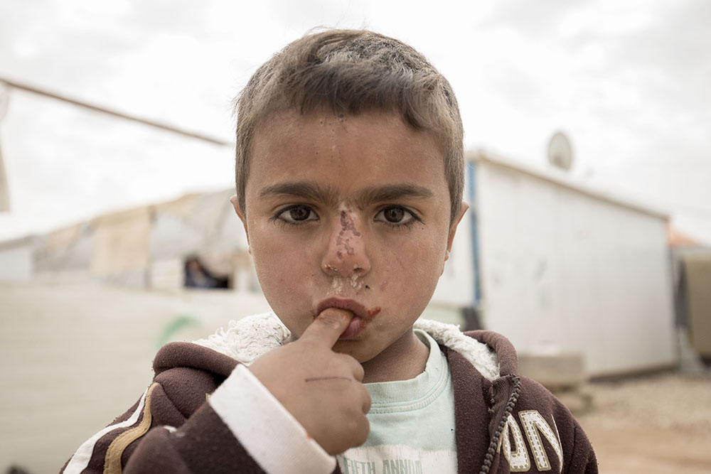 Portrait image of refugee kid